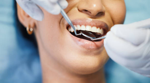 Best Root Canal Treatment  in Hiram, OH